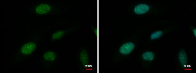 ATRX Antibody (4212) - Azide and BSA Free