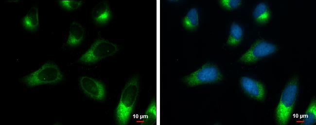 RRBP1 Antibody (5610) - Azide and BSA Free
