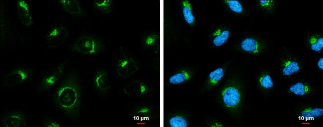 Coatomer Subunit Delta Antibody (1318)