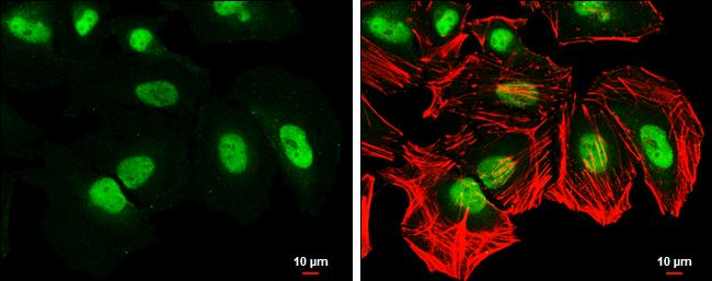 CSE1L/CAS/Exportin-2 Antibody (5111) - Azide and BSA Free