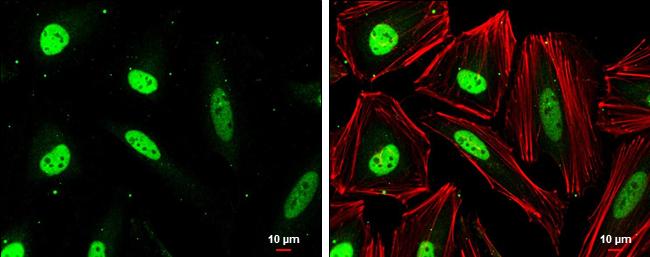 CSE1L/CAS/Exportin-2 Antibody (729) - Azide and BSA Free
