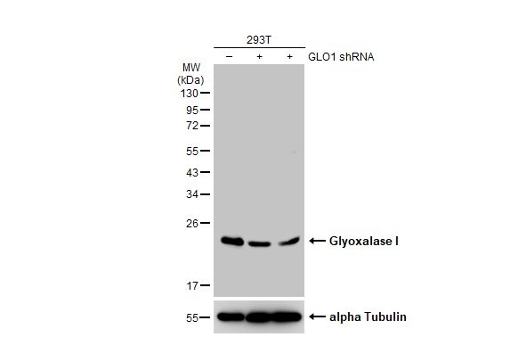 Glyoxalase I Antibody (266)
