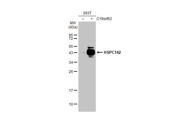 MERIT40/HSPC142 Antibody (1251)
