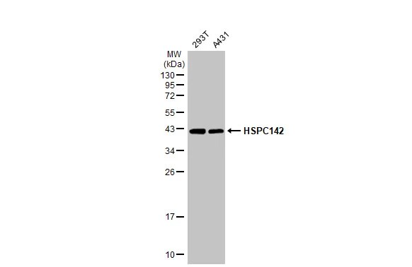 MERIT40/HSPC142 Antibody (1251)
