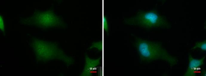 MERIT40/HSPC142 Antibody (1251) - Azide and BSA Free