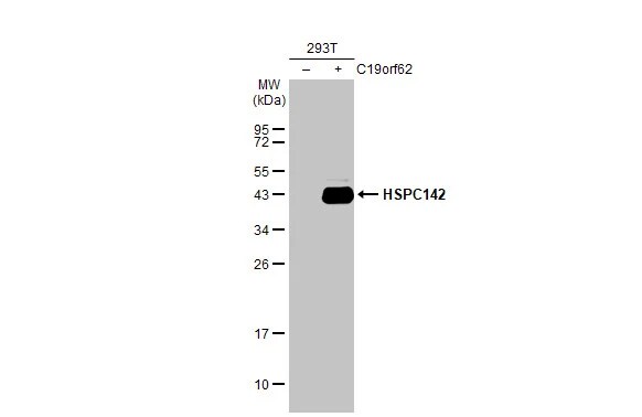 MERIT40/HSPC142 Antibody (2810)