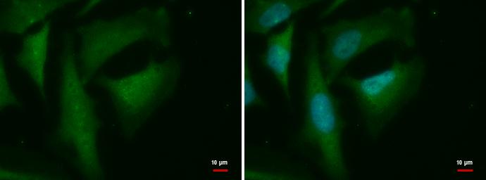 MERIT40/HSPC142 Antibody (2810) - Azide and BSA Free