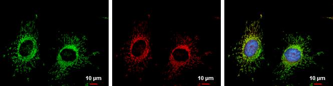 TTC11 Antibody (9810) - Azide and BSA Free