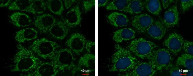 ETHE1 Antibody (1621) - Azide and BSA Free
