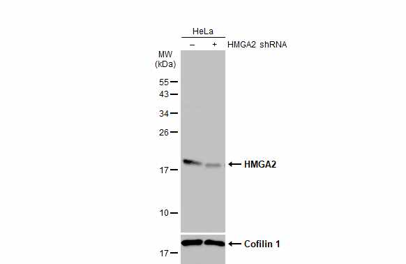 HMGA2 Antibody (763)