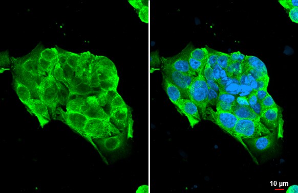 NKG2D/CD314 Antibody