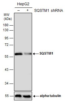 p62/SQSTM1 Antibody (1478) - Azide and BSA Free