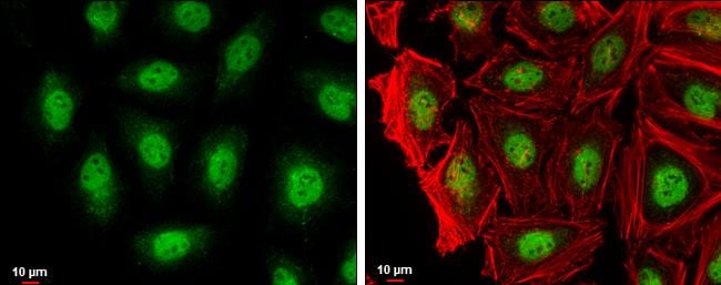 RAG2 Antibody - BSA Free
