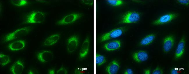 RRBP1 Antibody (1611) - Azide and BSA Free