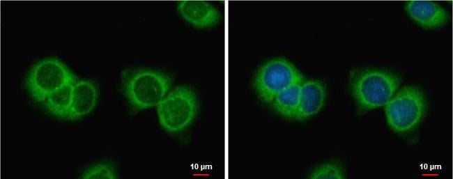 MIS/AMH Antibody - BSA Free