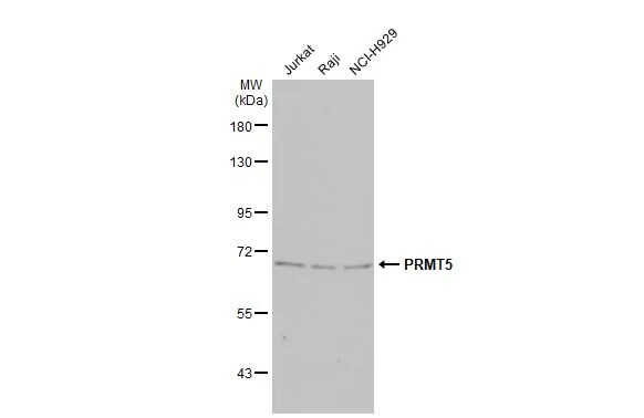 PRMT5 Antibody (3610)