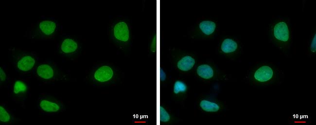 Elp3 Antibody (11811) - Azide and BSA Free