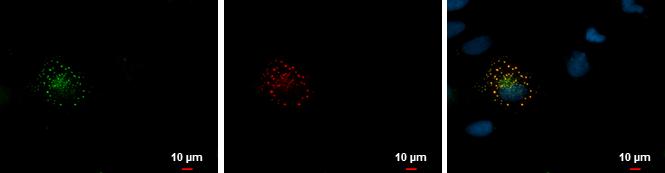 mCherry Antibody