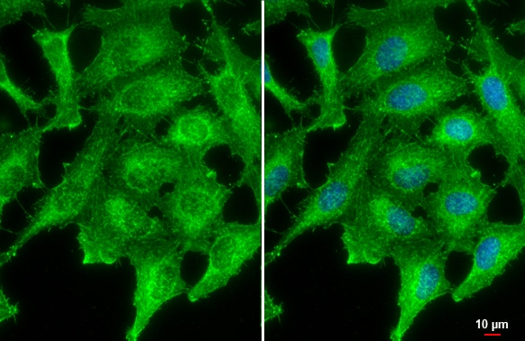 PNPT1 Antibody (4C11)