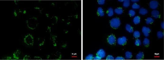Collagen XI alpha 2 Antibody (473) - Azide and BSA Free