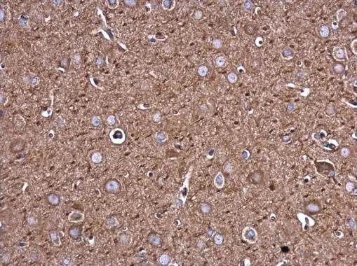 Filamin B Antibody (1372) - Azide and BSA Free