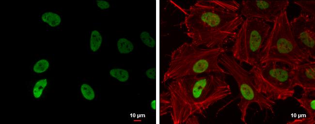 HIST1H3A [ac Lys9] Antibody (464) - Azide and BSA Free