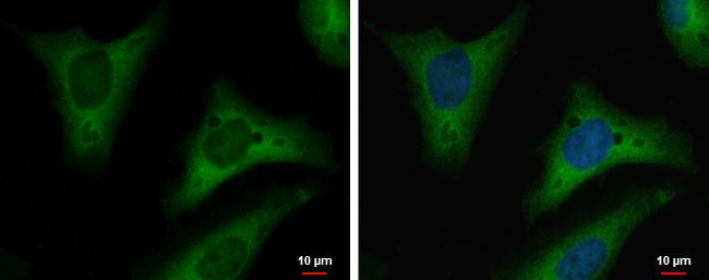 Triosephosphate isomerase Antibody (181) - Azide and BSA Free