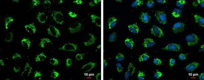 Glutaminase Antibody (3211) - Azide and BSA Free