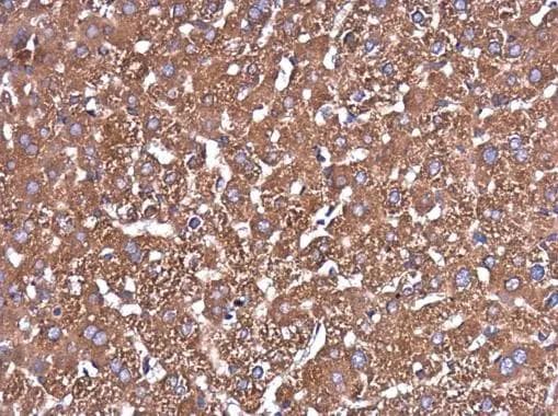 Glutaminase Antibody (3211) - Azide and BSA Free