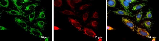 TTC11 Antibody (4211) - Azide and BSA Free