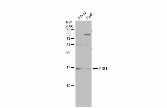 TTC11 Antibody (4211) - Azide and BSA Free