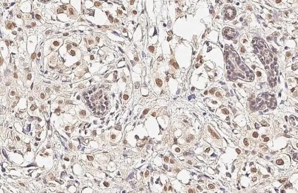 Nuf2 Antibody (312)