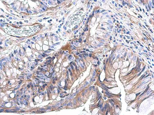 Ras Antibody