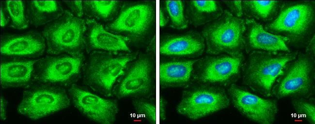 Fatty Acid Synthase/FASN Antibody (325) - Azide and BSA Free