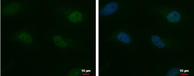 MTF2 Antibody - BSA Free