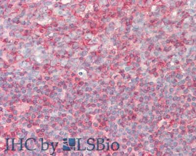 PIP5K1 alpha Antibody