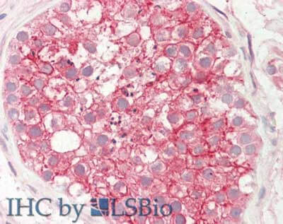 STIM1 Antibody