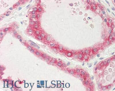 STIM1 Antibody