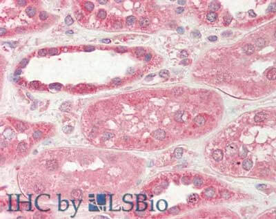 STIM2 Antibody