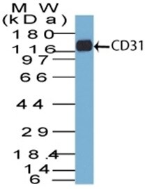 CD31/PECAM-1 Antibody (C31.7) - IHC-Prediluted Western Blot: CD31/PECAM-1 Antibody (C31.7) - IHC-Prediluted [NBP2-44333] -