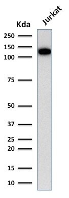 CD31/PECAM-1 Antibody (C31.3) - IHC-Prediluted Western Blot: CD31/PECAM-1 Antibody (C31.3) - IHC-Prediluted [NBP2-44334] -