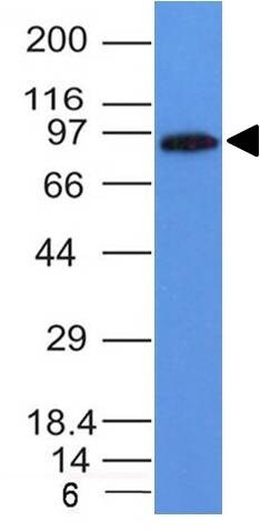 MALT1 Antibody (MT1/410) - IHC-Prediluted Western Blot: MALT1 Antibody (MT1/410) - IHC-Prediluted [NBP2-44348] -