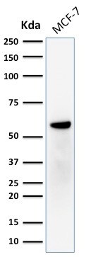 ER beta/NR3A2 Antibody (ERb455) - IHC-Prediluted Western Blot: ER beta/NR3A2 Antibody (ERb455) - IHC-Prediluted [NBP2-44365] -
