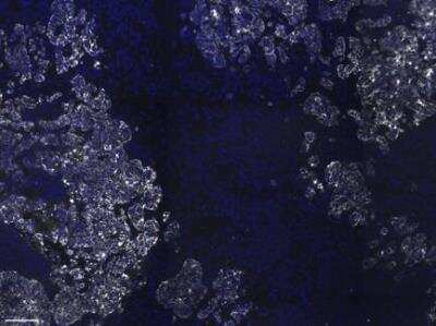 Cytokeratin, pan Antibody (PAN-CK (Cocktail))