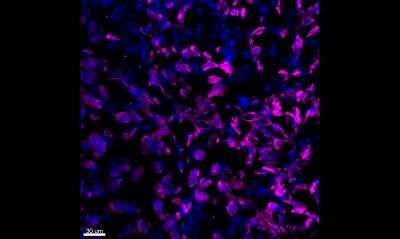 Cytokeratin, pan Antibody (PAN-CK (Cocktail))