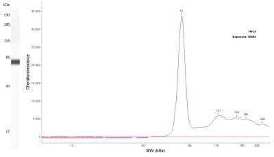 Fascin Antibody (FSCN1/417)