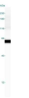 Fascin Antibody (FSCN1/417)
