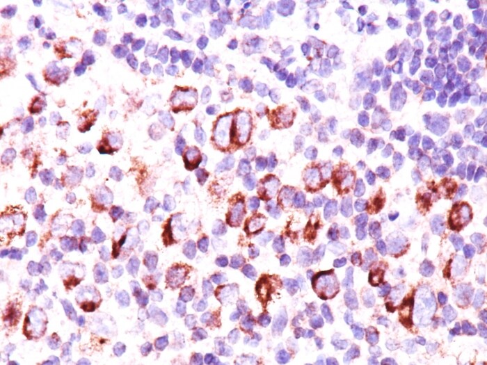 bcl-x Antibody (BX006 + 2H12) - IHC-Prediluted Immunohistochemistry-Paraffin: bcl-x Antibody (BX006 + 2H12) - IHC-Prediluted [NBP2-44417] -