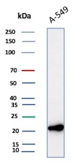 Bax Antibody (2D2) - IHC-Prediluted Western Blot: Bax Antibody (2D2) - IHC-Prediluted [NBP2-44418] -