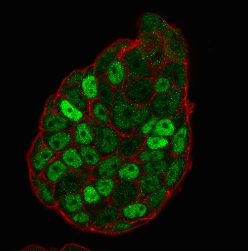 p27/Kip1 Antibody (SX53G8) - IHC-Prediluted Immunocytochemistry/ Immunofluorescence: p27/Kip1 Antibody (SX53G8) - IHC-Prediluted [NBP2-44493] -